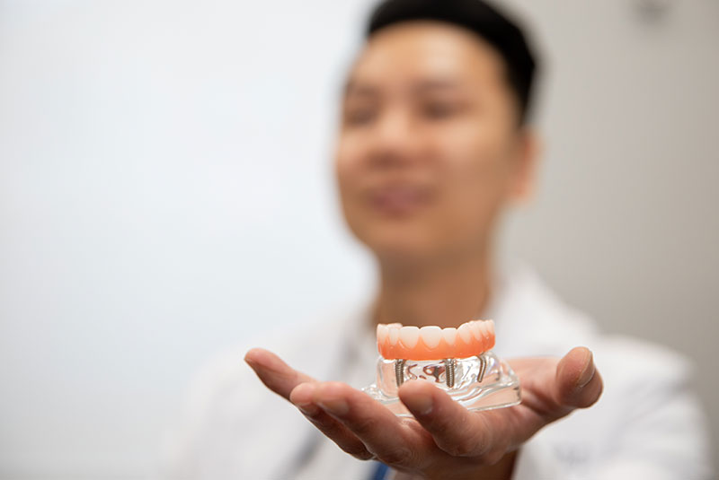 doctor holding full arch dental implant