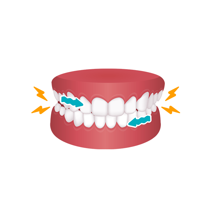 Grinding teeth